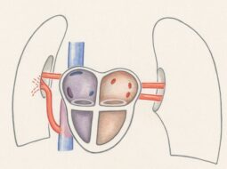 Scott Saffold-Balloon Sinus Dilation